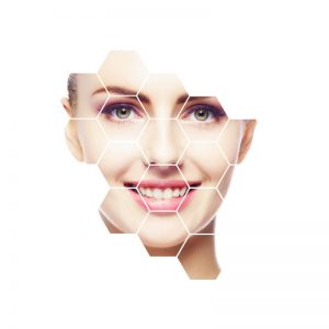 gummy smile cardiff